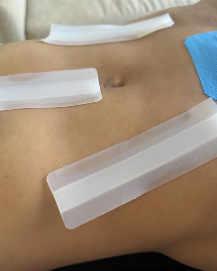 Post-operative recovery with professional instruments